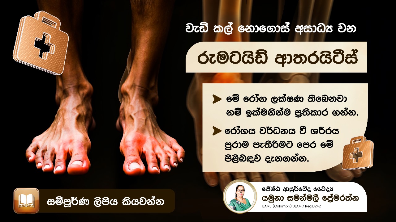 රුමටයිඩ් ආතරයිටීස්